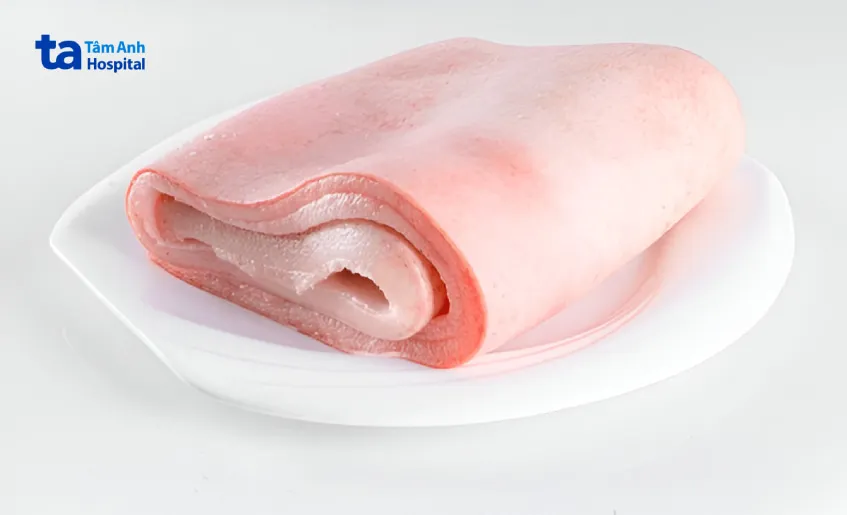 Da heo chủ yếu chứa collagen loại I, loại III và một lượng nhỏ các loại collagen khác như loại IV và V.